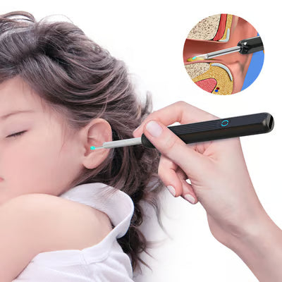 Smart Visual Earwax Removal Kit – See & Clean Safely at Home 👂📱